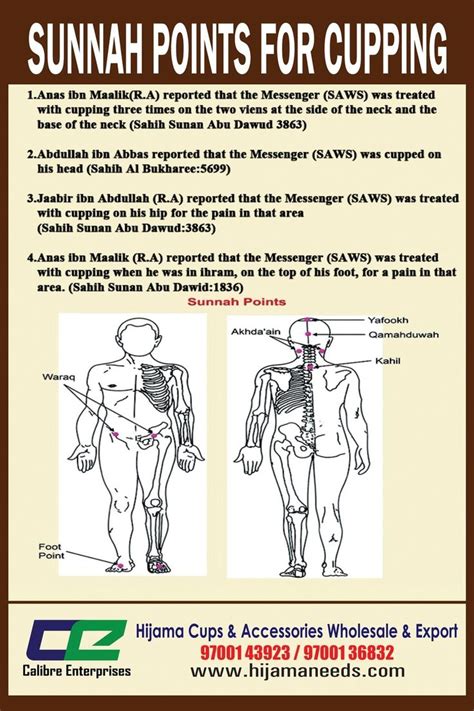 Pin by Abdul Rehman MS Khatri on Cupping | Hijama, Cupping points, Hijama points