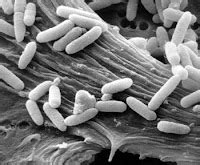 Questione della decisione: Continua il contagio da Escherichia coli, il batterio killer