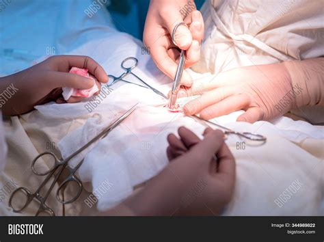 Surgeon His Assistant Image & Photo (Free Trial) | Bigstock