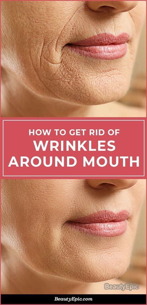 4 Ways To Get Rid Of Wrinkles Around Mouth Naturally | Mouth wrinkles, Face wrinkles, Wrinkles ...