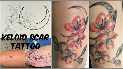 Keloid Scar Tattoo Cover Up - werohmedia