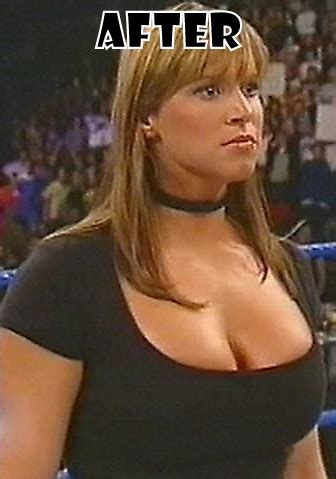 Stephanie McMahon Plastic Surgery Before and After Breast Implants Photos