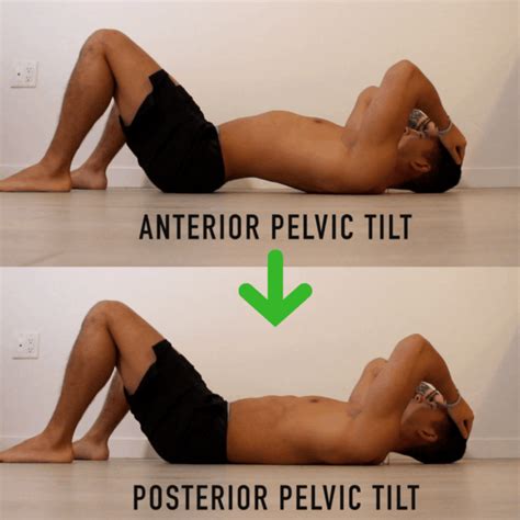 Fix Anterior Pelvic Tilt in 10 Minutes Per Day with This Corrective Routine