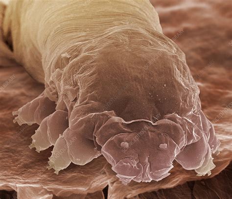 Eyelash mite, SEM - Stock Image - Z445/0309 - Science Photo Library