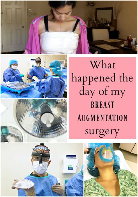 What happens the day of breast augmentation surgery