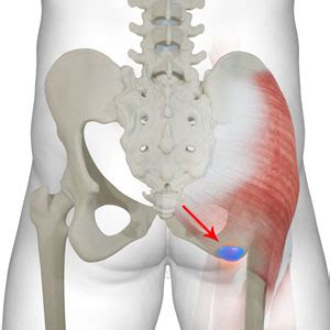 Ischial Pain When Sitting