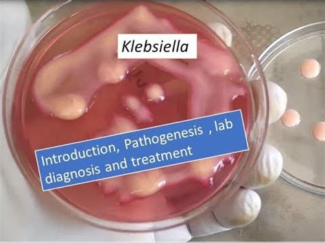 Klebsiella Videos : Klebsiella pneumoniae introduction, pathogenesis, lab diagnosis and treatment