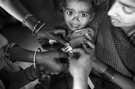 Child Malnutrition in India – Angel Navarrete