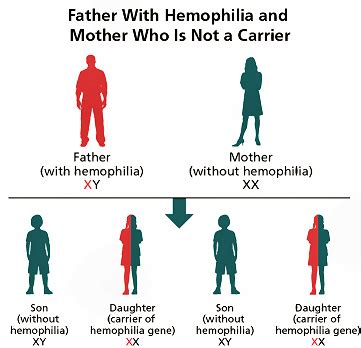 Christmas Disease - A rare genetic disorder in Males Only