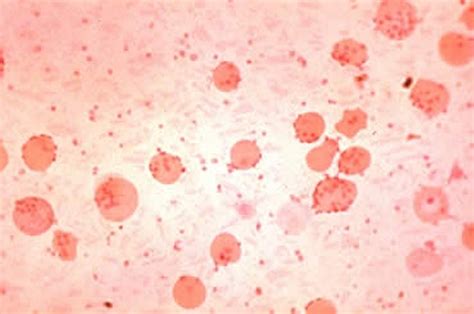 Hemotropic Mycoplasma Infections in Animals - Circulatory System - MSD Veterinary Manual