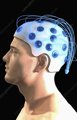 Electroencephalography - Stock Image - F002/3569 - Science Photo Library