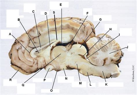 Sheep Brain Dissection labeled 2 Diagram | Quizlet