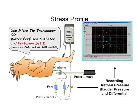 Urodynamics / Urodynamic Study - Urology Malaysia