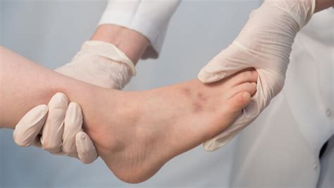 Sprain vs Fracture Foot: What’s the Difference