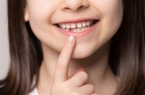 7 Children’s Teeth Problems Every parent Should Watch For