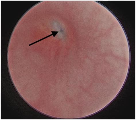 perineal urethrostomy cat stricture - Far Away Blogging Art Gallery