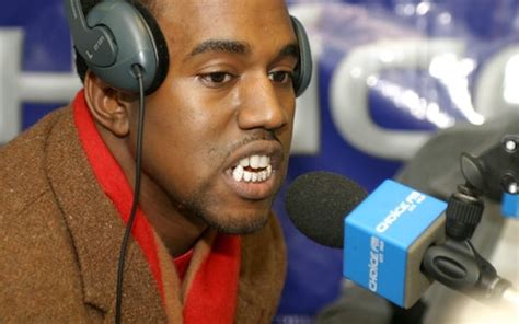 Kanye West installs $850,000 Jaws-inspired titanium teeth