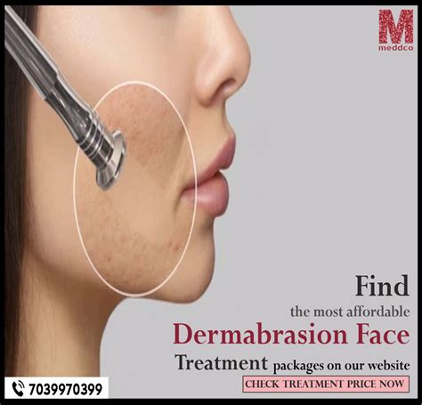 How often should you Dermabrasion your face?