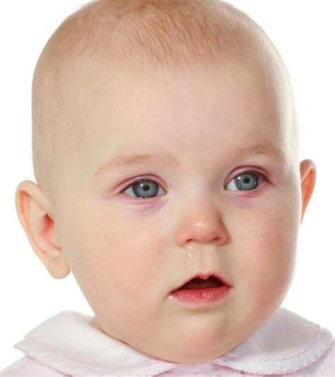 Pink Eye In Babies: Signs, Causes And Treatment