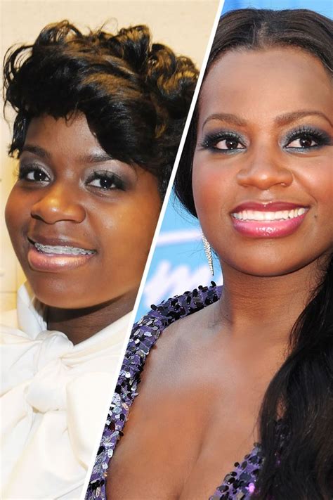 Famous Faces with Braces | Celebrities with braces, Fantasia barrino, Celebrity teeth