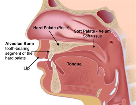 What Causes Cleft Lips and Palates? - EarWell Center of Excellence