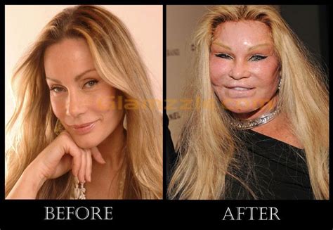 Unveiling The Transformation: Jocelyn Wildenstein Before Cosmetic Surgery