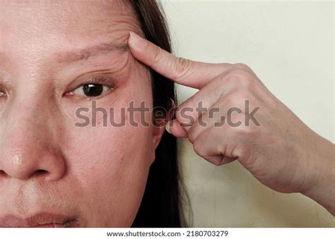 5 Sagging Eye Lids Images, Stock Photos, 3D objects, & Vectors | Shutterstock