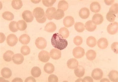 Free picture: red, blood, cell, infection, plasmodium vivax, mature, trophozoite, stage