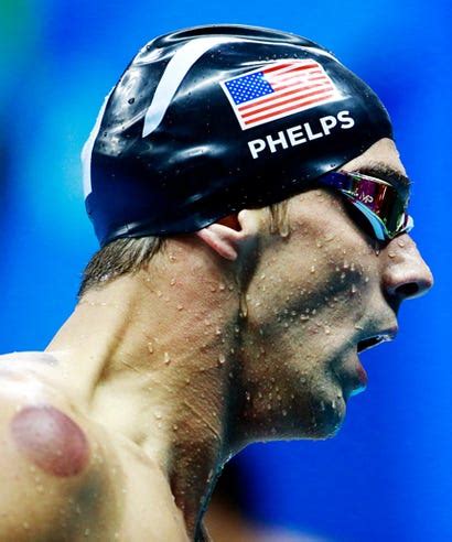 Michael Phelps Cupping Marks Details, Rio Olympics 2016