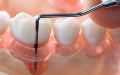How Does Periodontal Disease Affect My Body? - Loop Perio