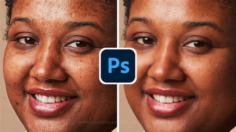 How to Remove Pimples from Face in Photoshop: Skin Retouching & Photo Editing for Beginners ...