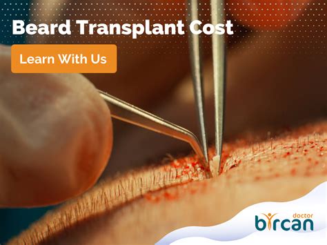 Beard Transplant Cost » Dr. Gökhan Bircan