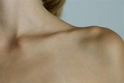 Broken Collarbone: Symptoms, Causes, Diagnosis, and Treatment