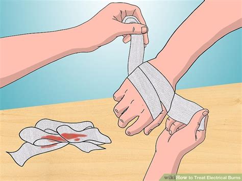 How to Treat Electrical Burns (with Pictures) - wikiHow