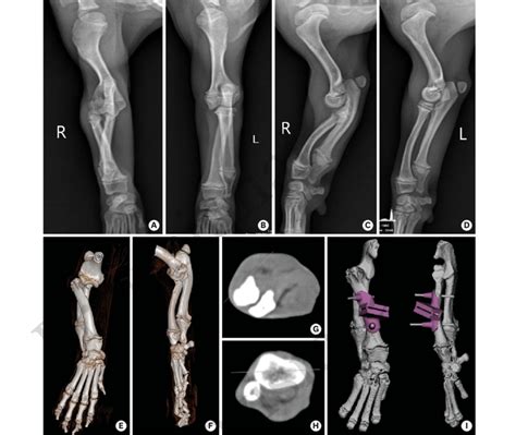 Radiographic images of both forelimbs and surgical planning before... | Download Scientific Diagram