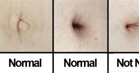 10 Strange Things You Probably Didn't Know About Your Belly Button ...