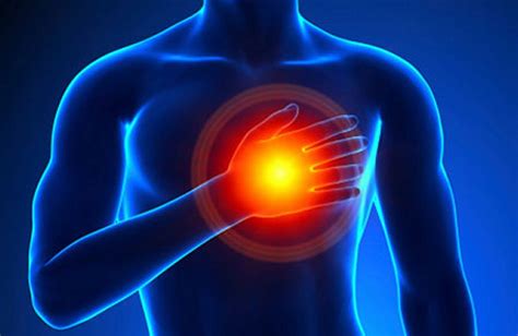 Chest-pain follow-up linked to better survival, heart health – Finesse ...