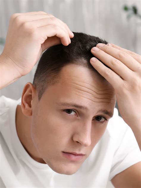 What Are Hair Transplant Alternatives - Blog | IMI