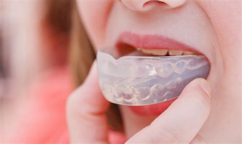 The Benefits of Using Mouthguards - Safeguard Your Oral Health