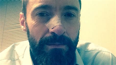 Hugh Jackman treated for skin cancer again, sports bandage in new photo ...