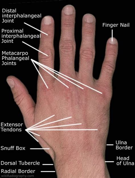 Hand/Wrist | Hand wrist, Hand therapy, Anatomy