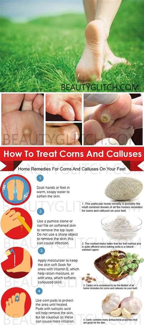 Home Remedies For Corns And Calluses On Your Feet #WomensSkinCareSimple #HardSkinHands | Foot ...