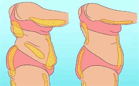 Cuáles son los diferentes tipos de grasa en el cuerpo humano