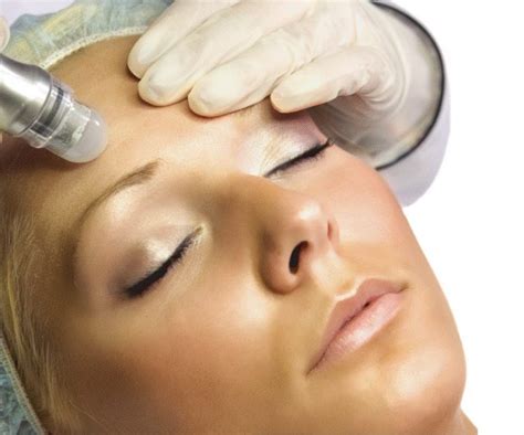 microdermabrasion-facial - Blush