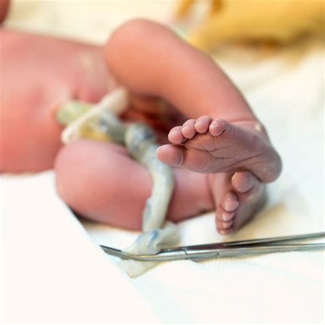 Delayed Cord Clamping And The Umbilical Cord - Nurtured Birth