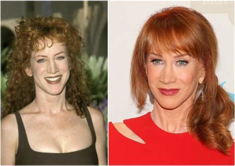 Kathy Griffin`s height, weight. Her plastic surgeries