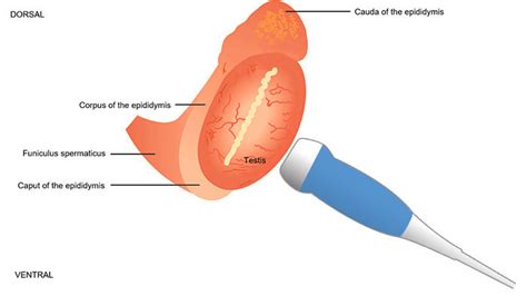 Testicular Ultrasound | Steinberg Urology