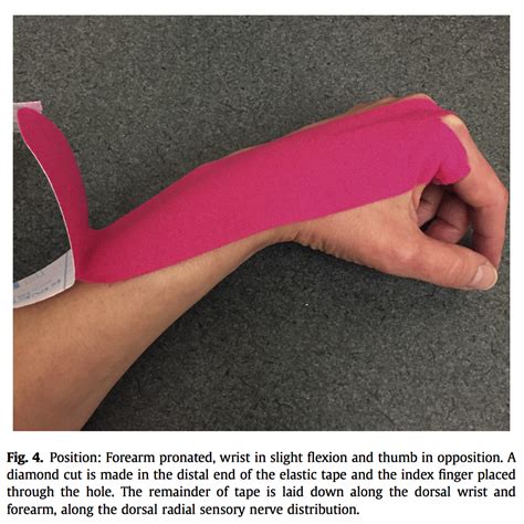 Two Ways to Tape the Wrist: Rigid Tape and Kinesiology Tape ...