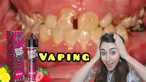 Vaping Risks - What Can Vaping Do To Your Mouth, Teeth, Braces & Invisalign - YouTube