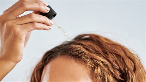 Understanding Moist Dandruff: Causes and Remedy – bluewhalefashion.com